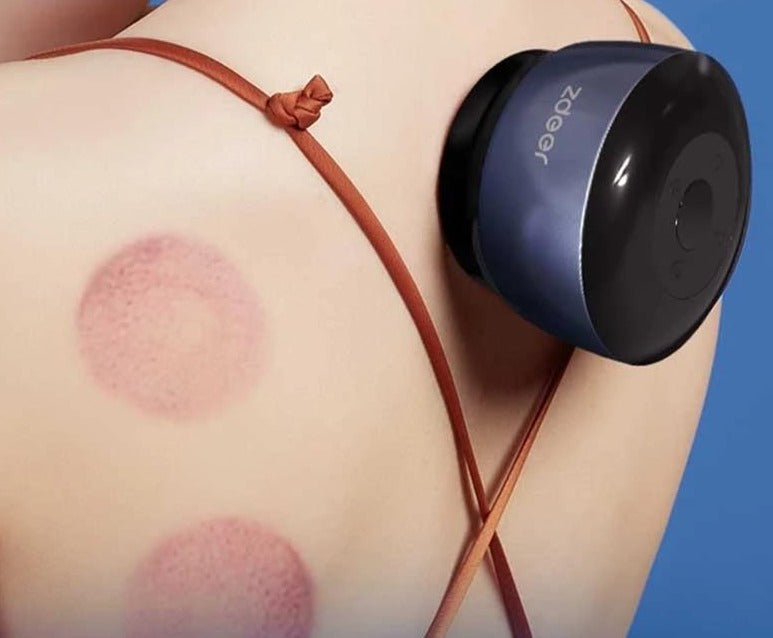 Intelligent Cupping Massager